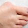 hallux rigidus